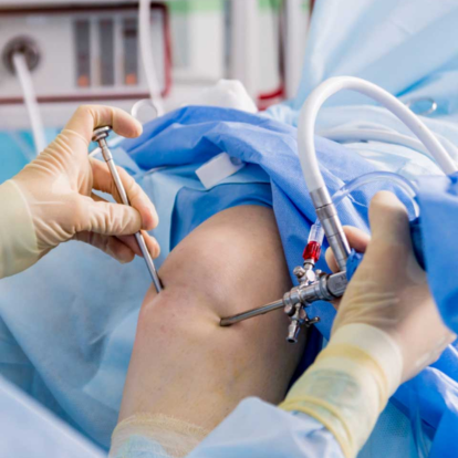 Sports Injury Arthroscopy