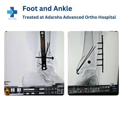 Foot Pain Treatment