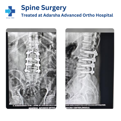 Spine Recovery